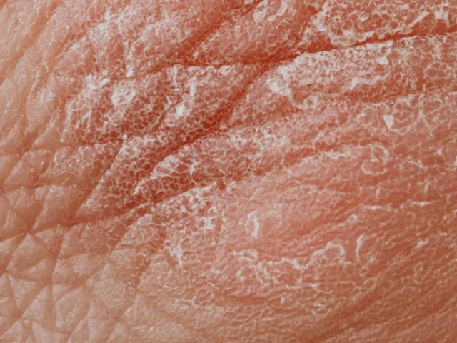 Common signs of food sensitivity including skin issues, bloating, fatigue, and digestive discomfort